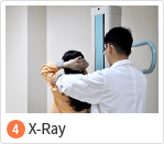 4. X-Ray