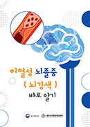 허혈성뇌졸중(뇌경색) 바로알기