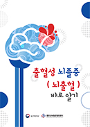 출혈성뇌졸중(뇌출혈) 바로알기