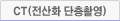 CT(전산화 단층촬영)