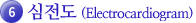 6.심전도(Electrocardiogram)