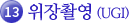 13.위장촬영(UGI)
