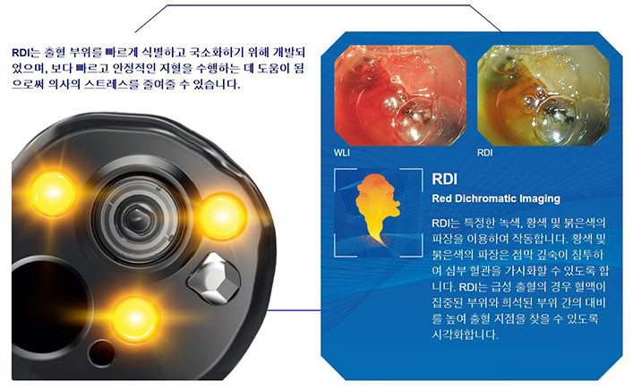 rdi